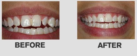 Cosmetic Dentistry