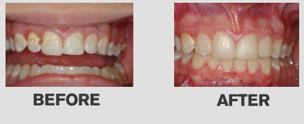 Restoration Dentistry