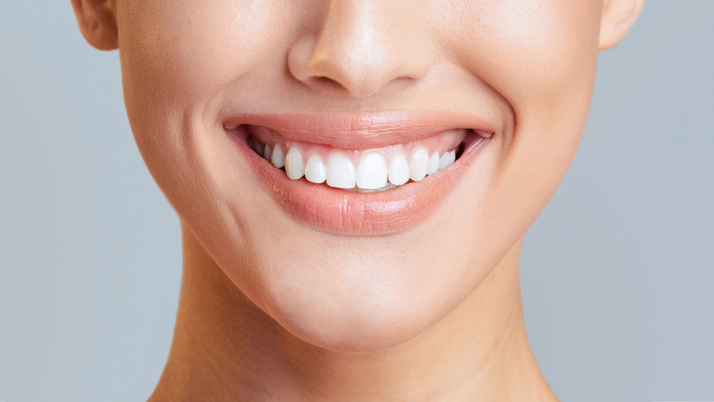 Teeth Whitening in Urbandale